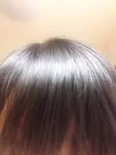 切りすぎた！髪を早く伸ばす栄養素は男女で違う説は本当か、医師に聞いてみた