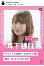 中川翔子、2年前の耳下腺腫瘍手術体験を公表　顔面麻痺リスク8割の難手術を乗り越える