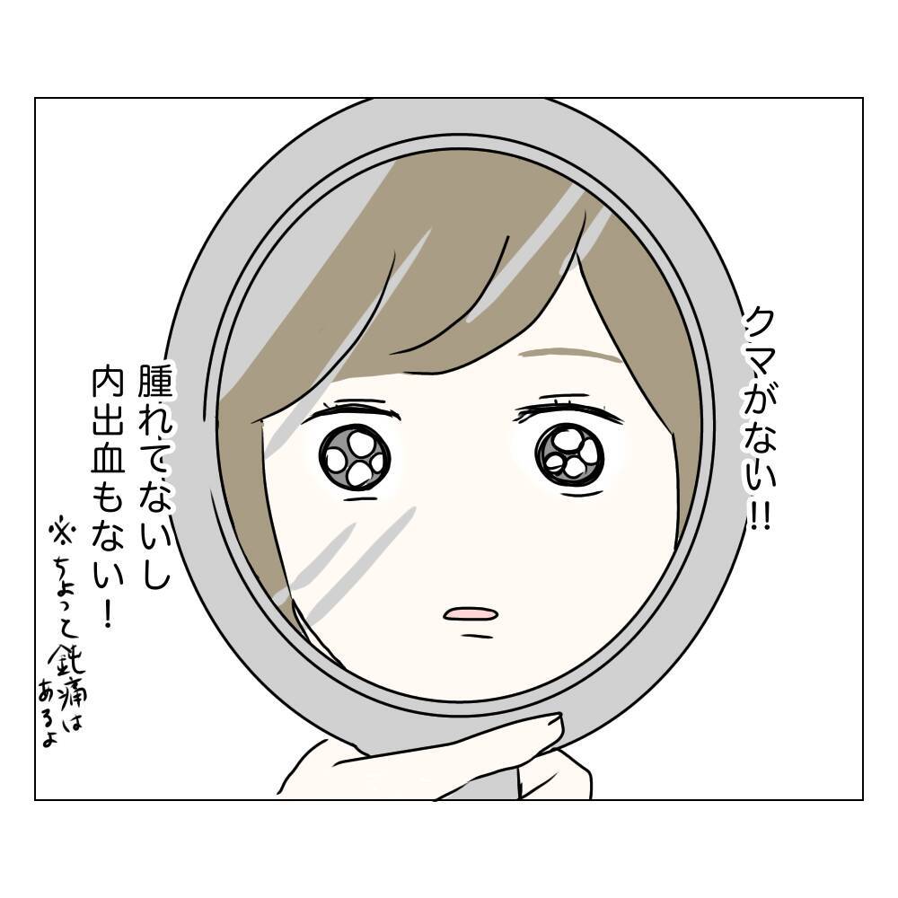 麻酔から覚め、手術後の顔を鏡で確認…目元はどうなった!?