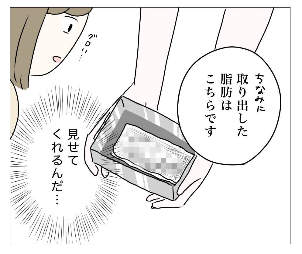 麻酔から覚め、手術後の顔を鏡で確認…目元はどうなった!?