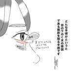 「「具合悪いの？」目の下にクマがあると人に心配される…私が整形を決断した理由」の画像2