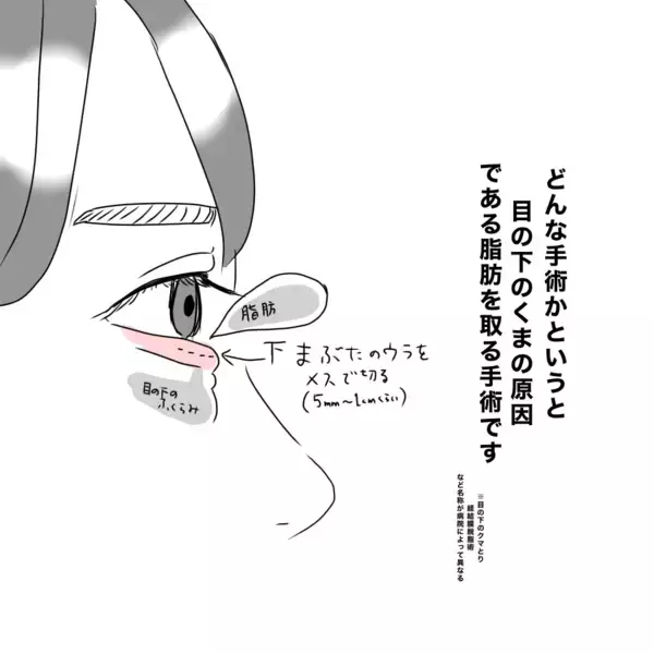 「「具合悪いの？」目の下にクマがあると人に心配される…私が整形を決断した理由」の画像