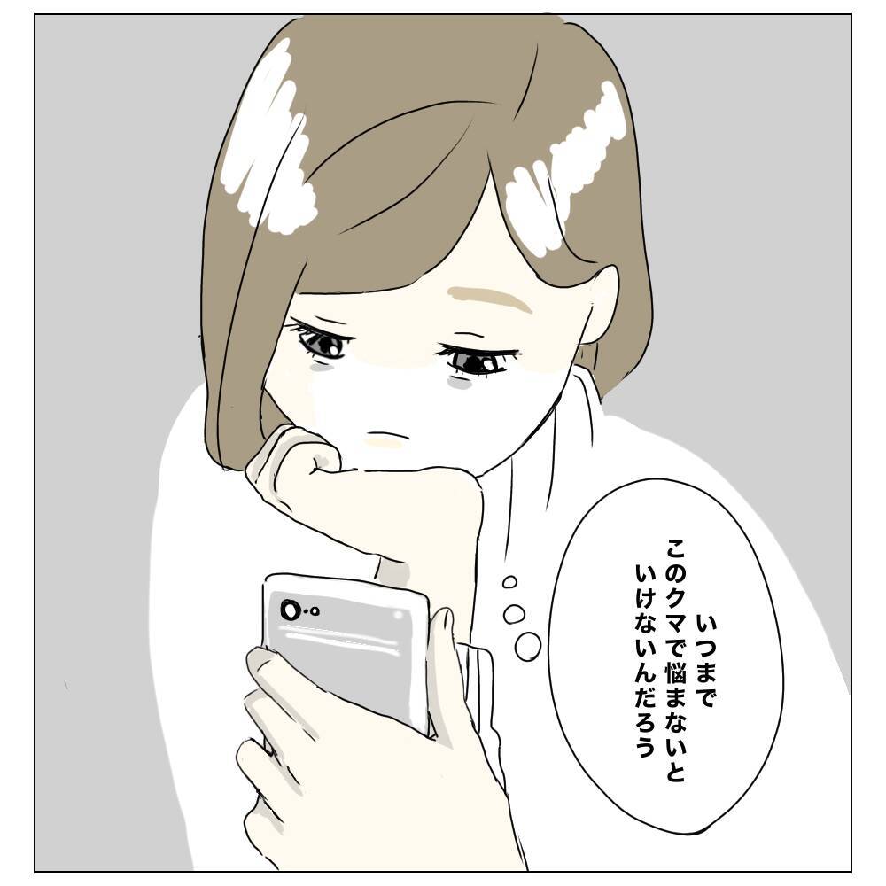 「具合悪いの？」目の下にクマがあると人に心配される…私が整形を決断した理由