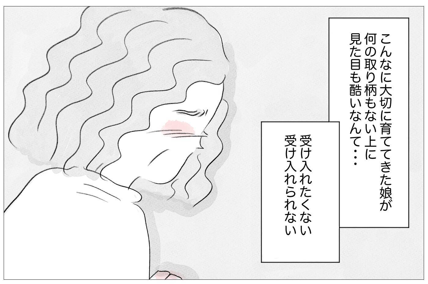 「娘が悲惨すぎて見ていられない」何の取り柄もない娘に整形をさせた本当の理由