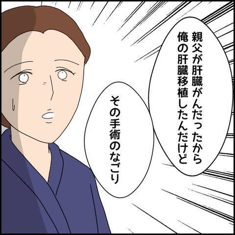 胸の赤みはなぜ？ 彼の衝撃的な過去が明らかに