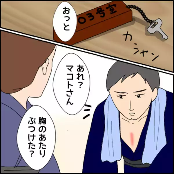 「胸の赤みはなぜ？ 彼の衝撃的な過去が明らかに」の画像