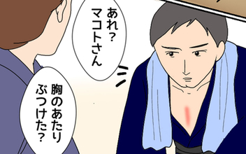 【漫画】胸の赤みはなぜ？ 彼の衝撃的な過去が明らかに【みんな知らない Vol.6】