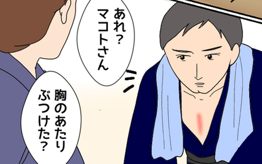 胸の赤みはなぜ？ 彼の衝撃的な過去が明らかに