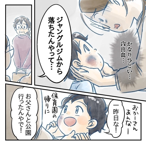 【漫画】夫と公園に行った息子、ジャングルジムから落ちてケガ【アナタの大丈夫がキライ Vol.17】の画像