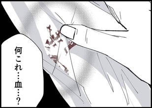 【漫画】ワイシャツが血だらけ！ 夫が身体をボリボリかくように【僕と帰ってこない妻 Vol.369】