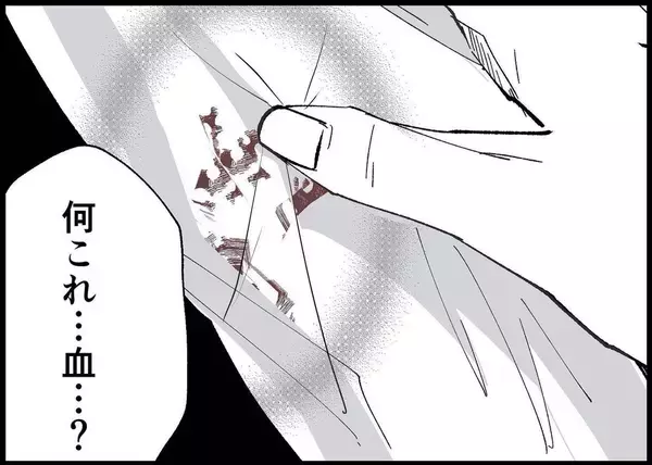 「【漫画】ワイシャツが血だらけ！ 夫が身体をボリボリかくように【僕と帰ってこない妻 Vol.369】」の画像