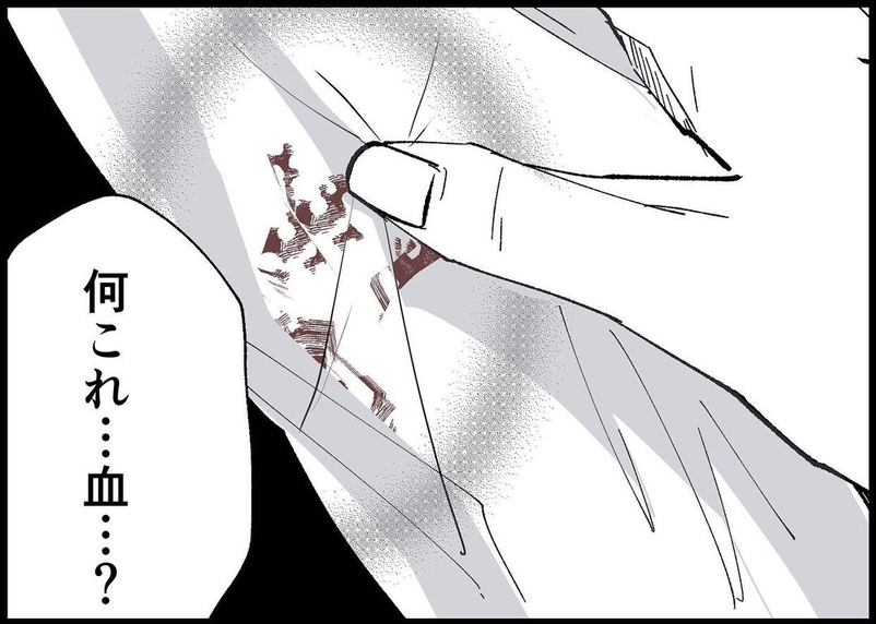 【漫画】ワイシャツが血だらけ！ 夫が身体をボリボリかくように【僕と帰ってこない妻 Vol.369】