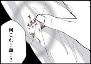 【漫画】ワイシャツが血だらけ！ 夫が身体をボリボリかくように【僕と帰ってこない妻 Vol.369】