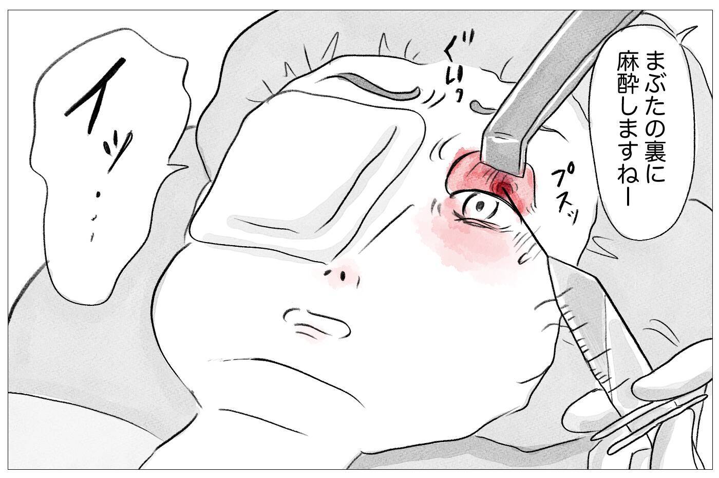 「その顔ひどいよ」母からの洗脳で＜整形しない私のまま生きる＞のは恐怖だった…