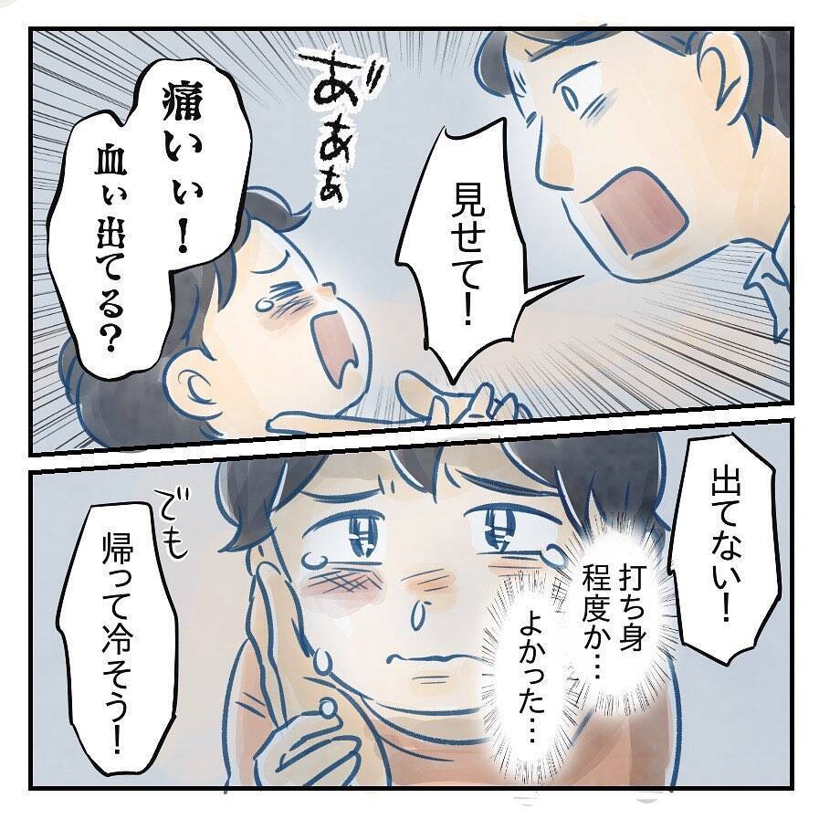 【漫画】目を離したすきに息子が遊具から足を滑らせ顔面殴打【アナタの大丈夫がキライ Vol.31】