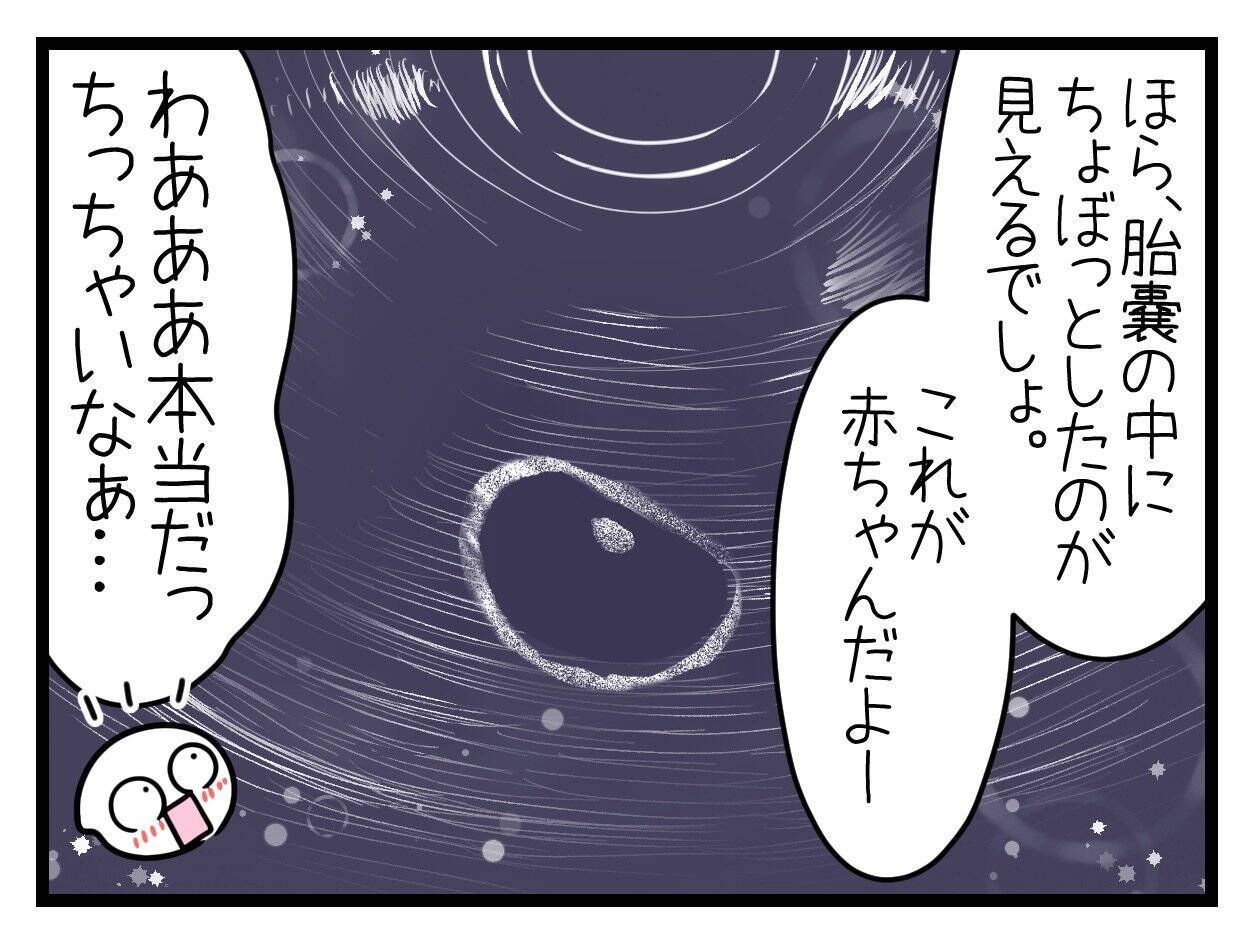 【漫画】つわりが始まり、何をどうしても気持ち悪い【一緒のお墓に入ろっか！ Vol.8】