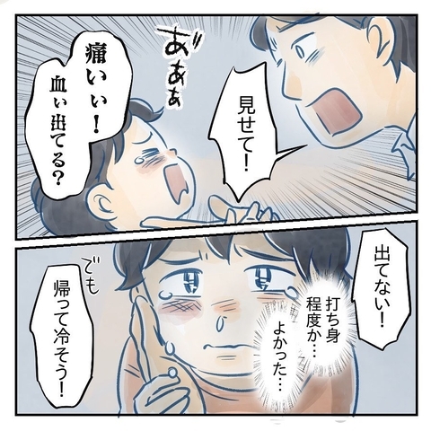 【漫画】目を離したすきに息子が遊具から足を滑らせ顔面殴打【アナタの大丈夫がキライ Vol.31】の画像