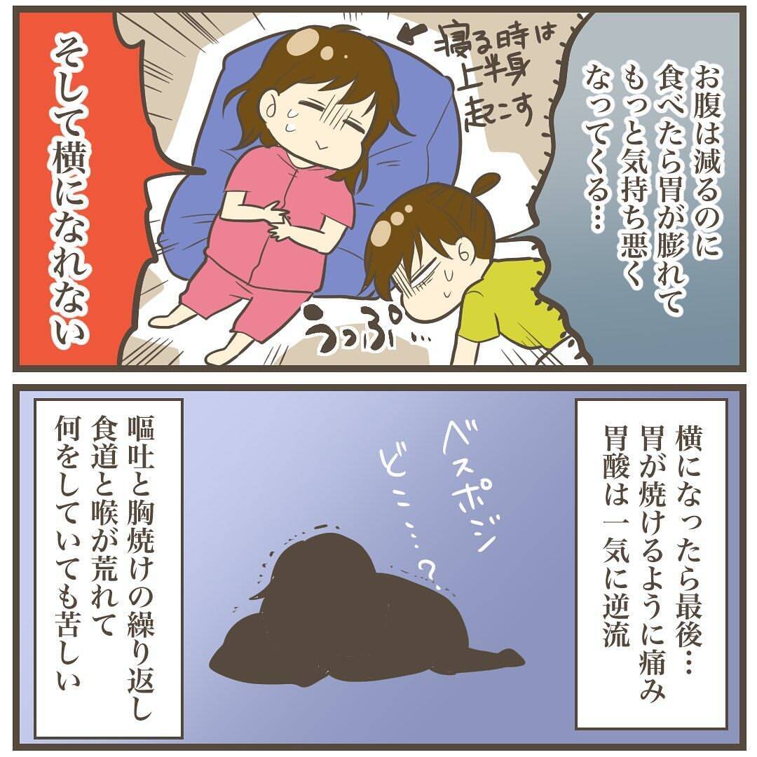 赤ちゃんに胃を圧迫された結果「逆流性食道炎」に　そして体重増加が止まらない