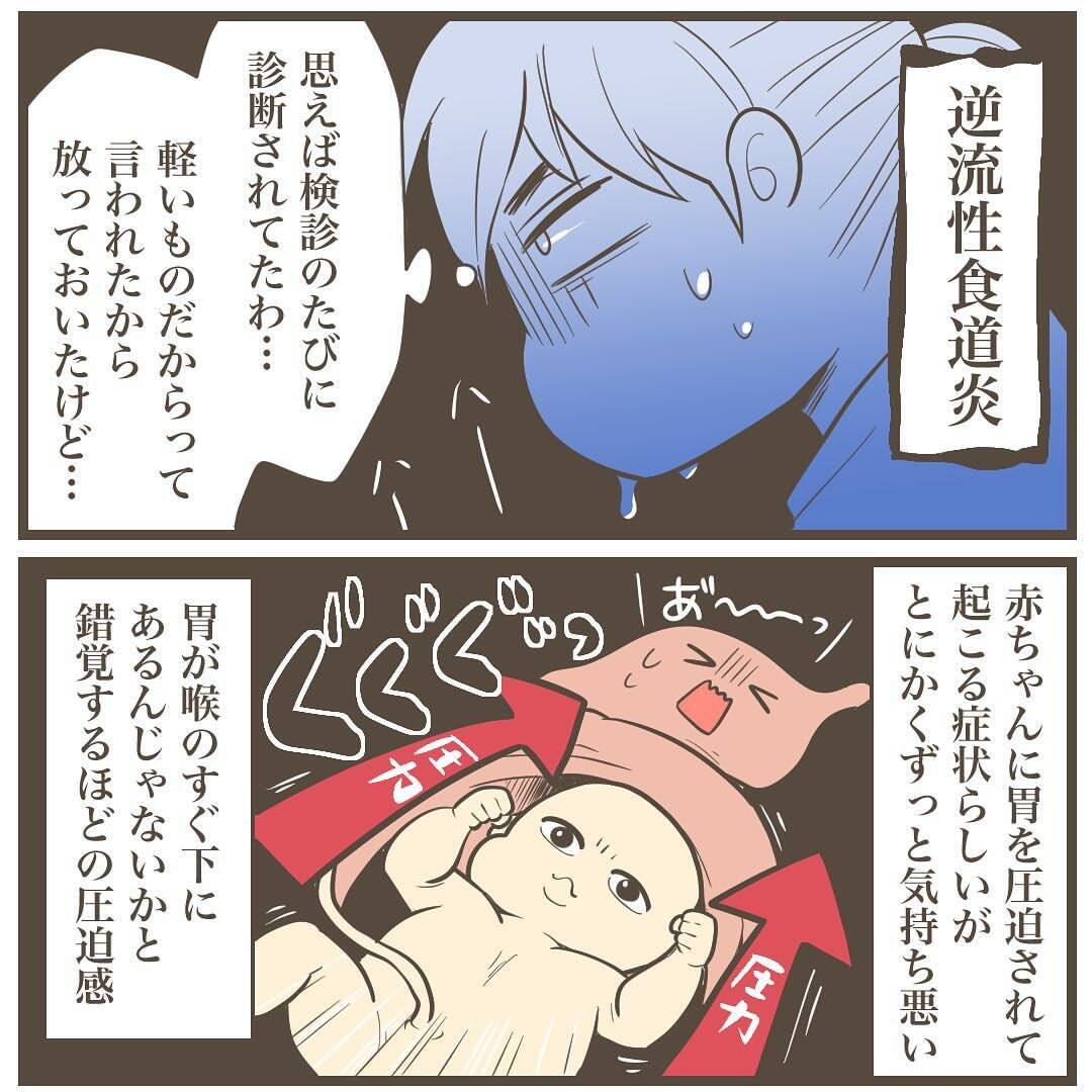 赤ちゃんに胃を圧迫された結果「逆流性食道炎」に　そして体重増加が止まらない