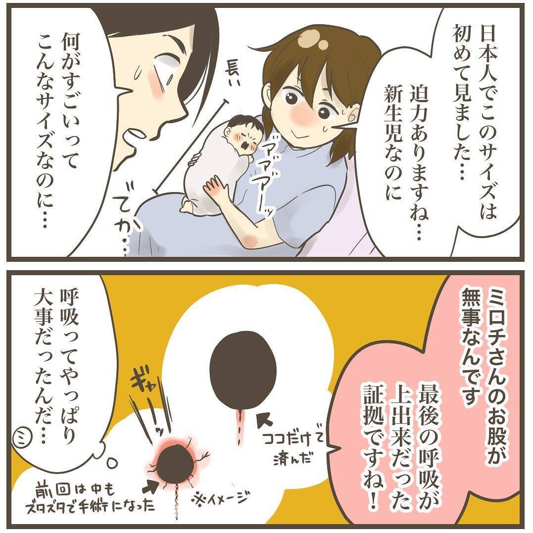 紛れもない巨大児！ 4452gのビッグベビーが誕生