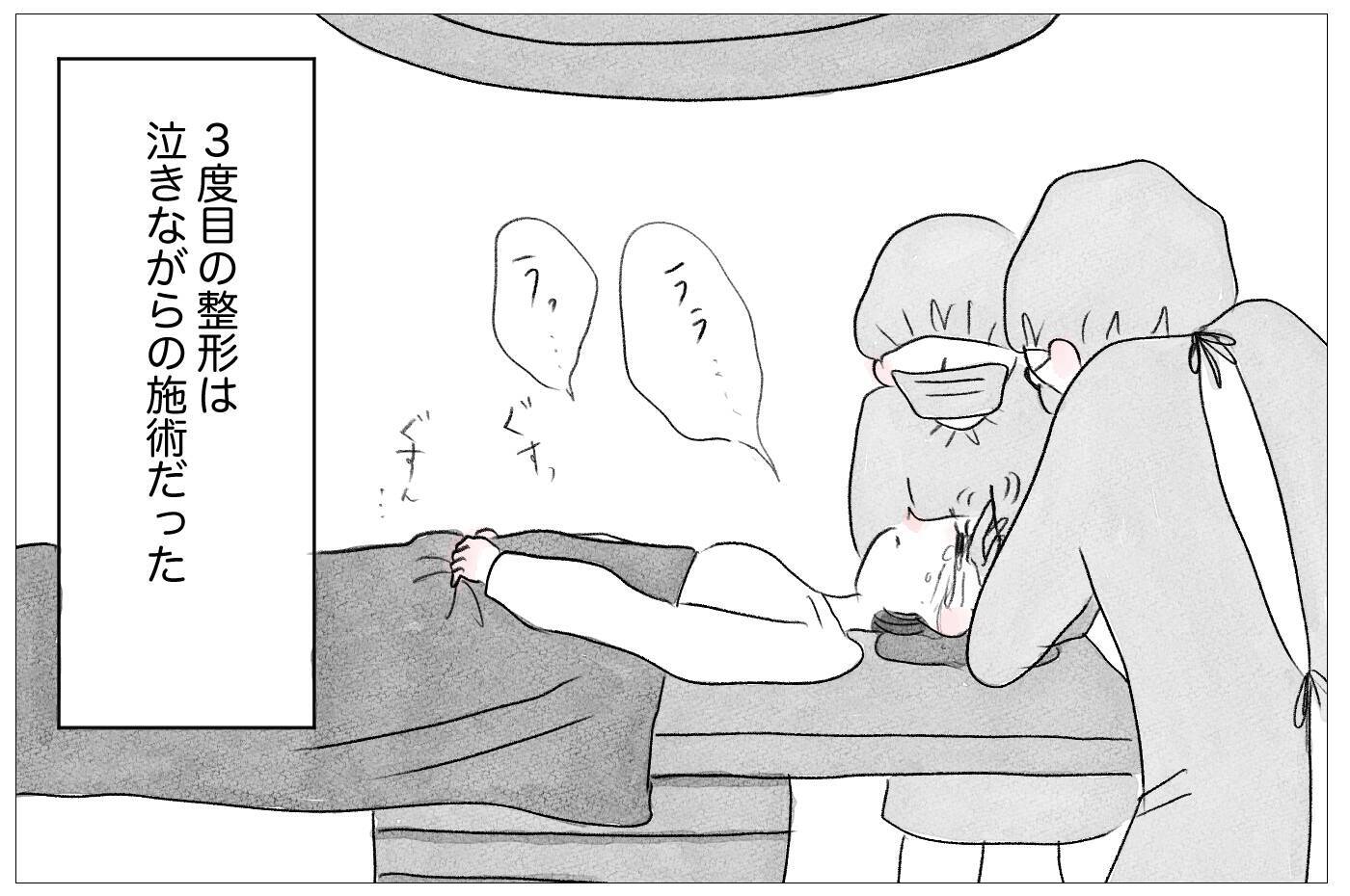 3度目の整形は泣きながらの施術　でも「やらなくちゃいけない」