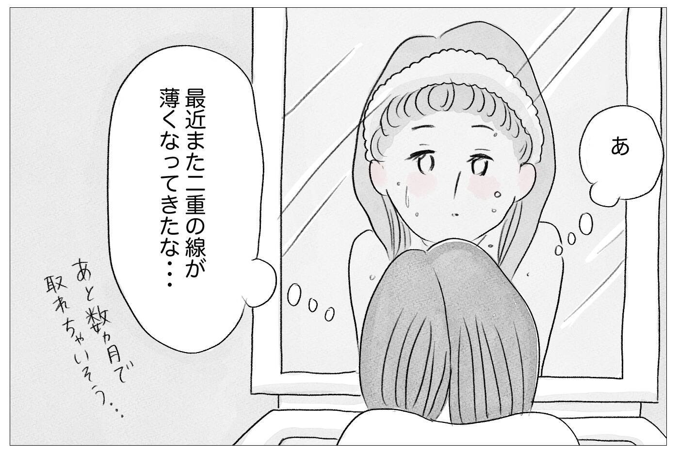 「ありのままで愛されたい」けど、私なんかは「整形しなくちゃいけない」