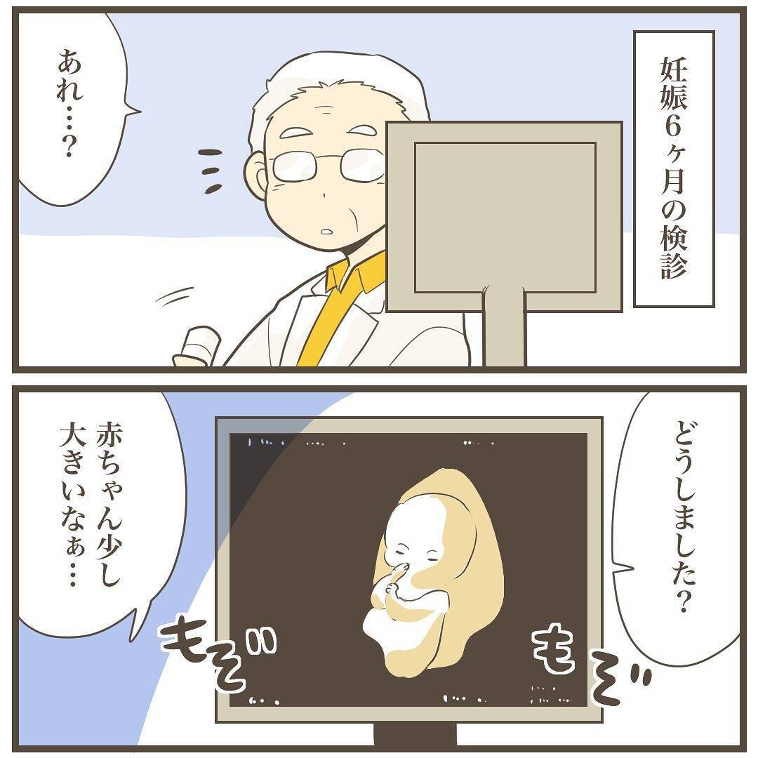 検診で赤ちゃんが大きいとの指摘　…少し大きいくらいの方が安心だよね？