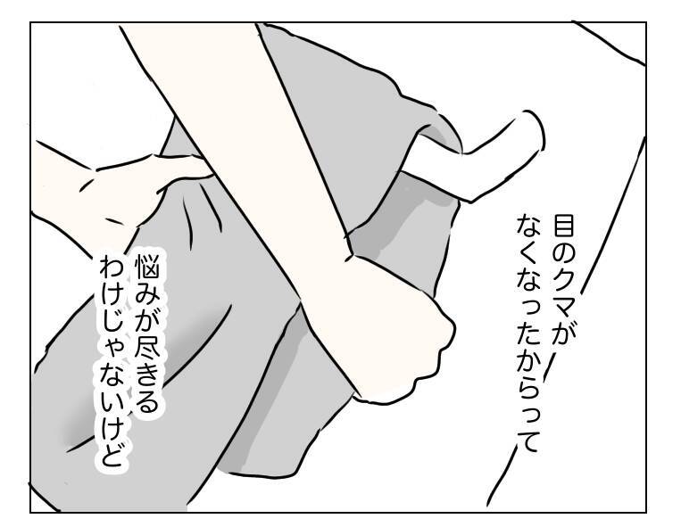 整形から3年が経過…コンプレックスだった目元は今どうなった？