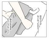 「整形から3年が経過…コンプレックスだった目元は今どうなった？」の画像7