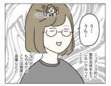 「整形から3年が経過…コンプレックスだった目元は今どうなった？」の画像3