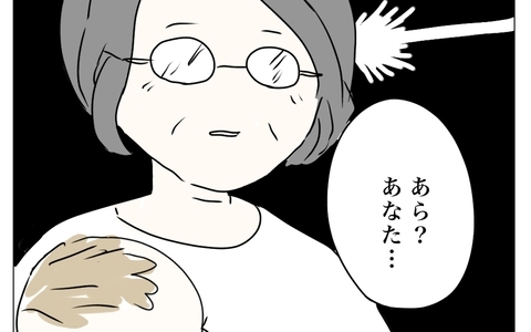 「あら？ あなた…」顔を見るなり母が目の違和感を指摘　整形がバレた!?　の画像