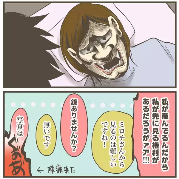 「感動…！ 陣痛の様子が変化し、赤ちゃんの髪の毛が見えてきた」の画像
