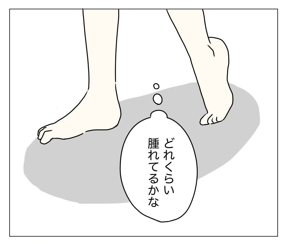 目の下が暗く見える？ 顔色も悪い!? 夫に整形を隠し通せるのか…！