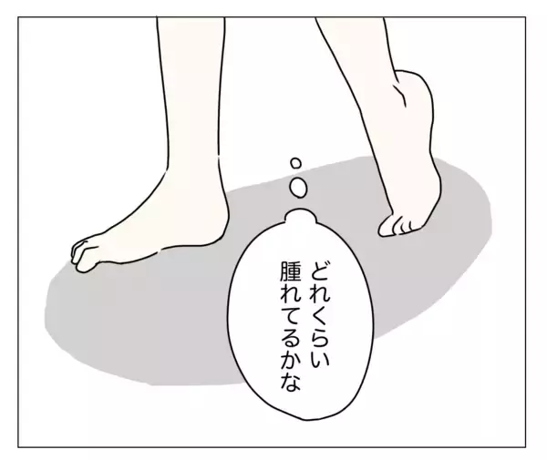 「目の下が暗く見える？ 顔色も悪い!? 夫に整形を隠し通せるのか…！」の画像