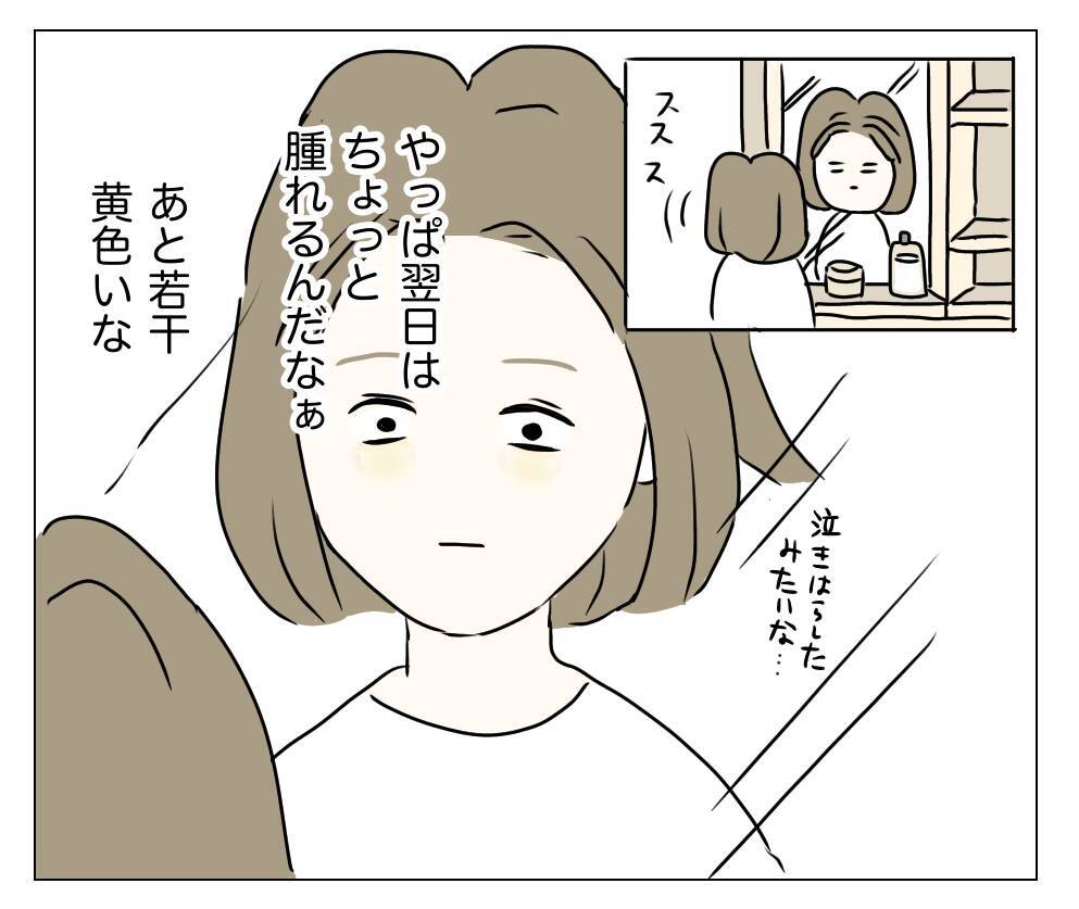 目の下が暗く見える？ 顔色も悪い!? 夫に整形を隠し通せるのか…！