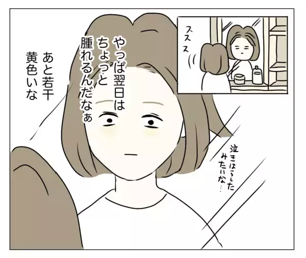 「目の下が暗く見える？ 顔色も悪い!? 夫に整形を隠し通せるのか…！」の画像
