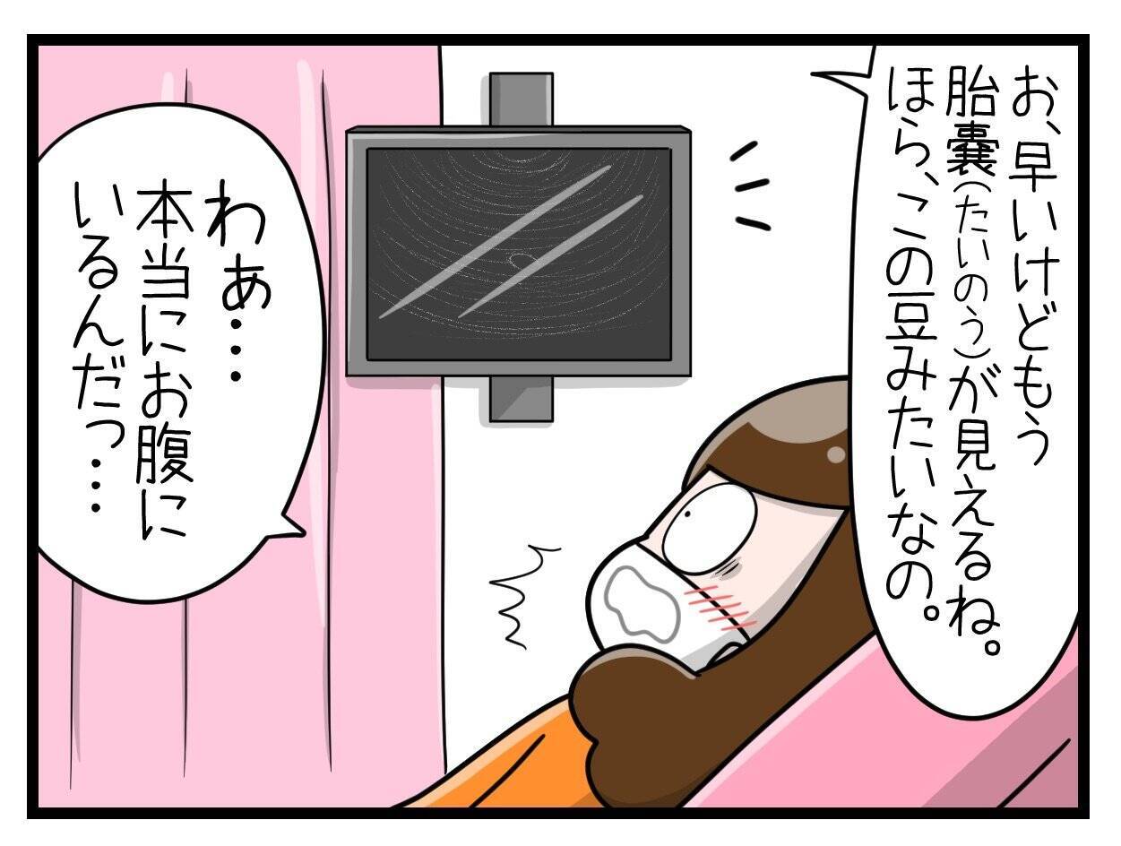 【漫画】産婦人科で診てもらったところ、やっぱり赤ちゃんがいた！【一緒のお墓に入ろっか！ Vol.6】