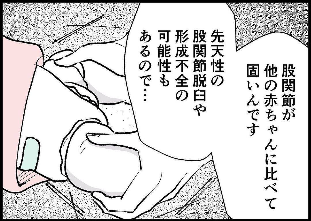 【漫画】子どもの股関節の問題で大学病院を勧められる　原因は？【僕と帰ってこない妻 Vol.342】
