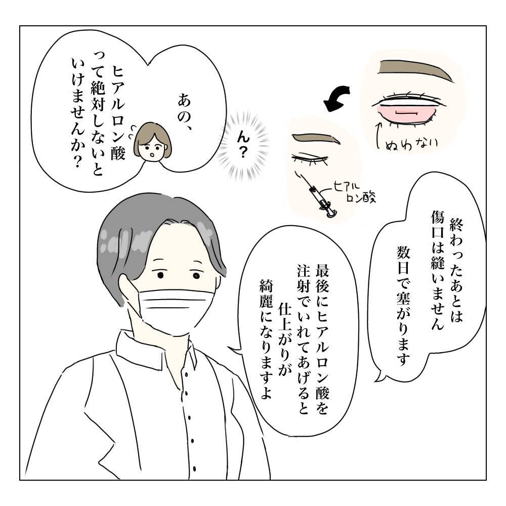 「費用は？ 術後の腫れは？」聞いてみないとわからない！ カウンセリングへ