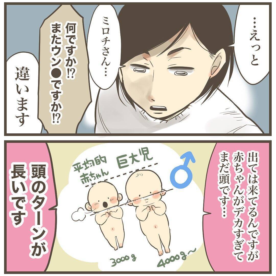 頭のターンが長いから!? 巨大児だからまだ頭しか出てこない！