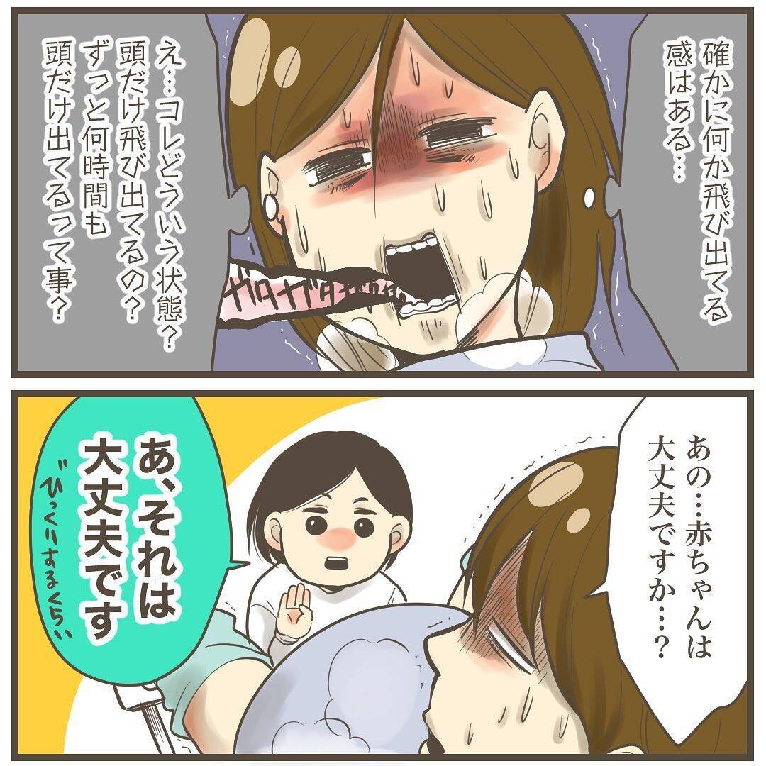 頭のターンが長いから!? 巨大児だからまだ頭しか出てこない！
