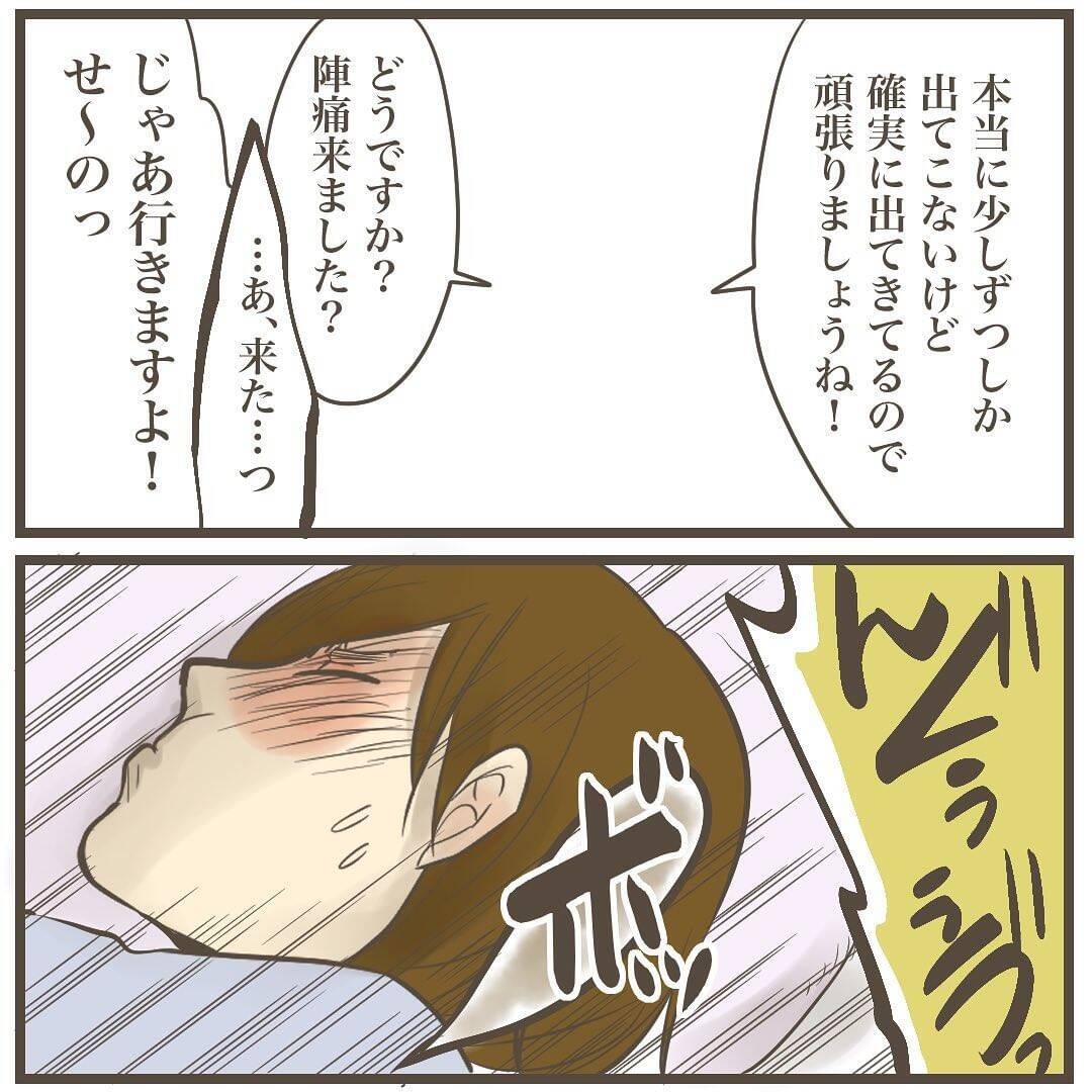 頭のターンが長いから!? 巨大児だからまだ頭しか出てこない！