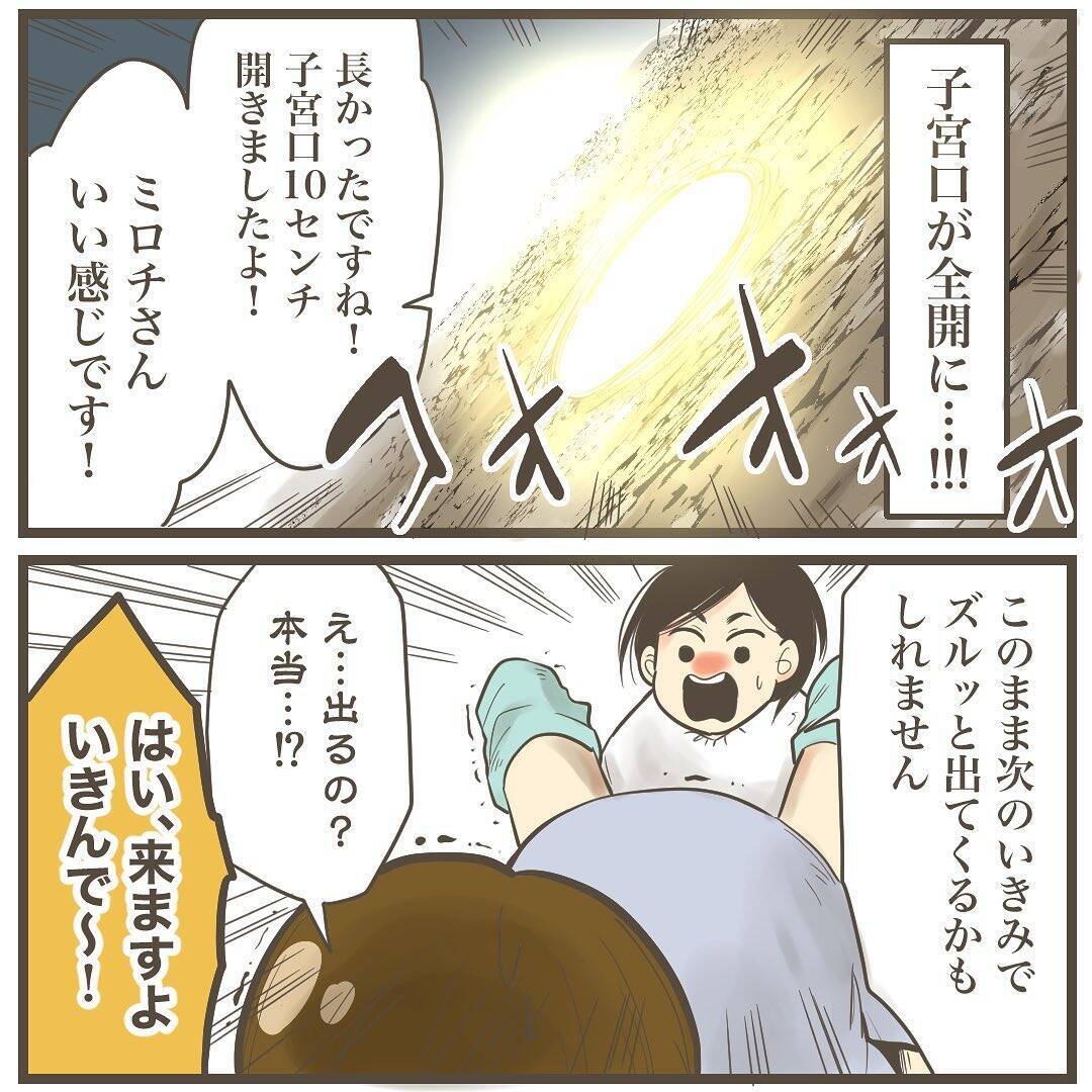 頭のターンが長いから!? 巨大児だからまだ頭しか出てこない！