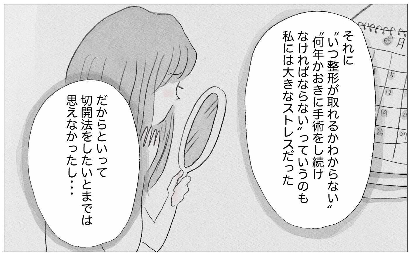 結婚式に向けて整形を勧める母　もう手術はしないと告げると…