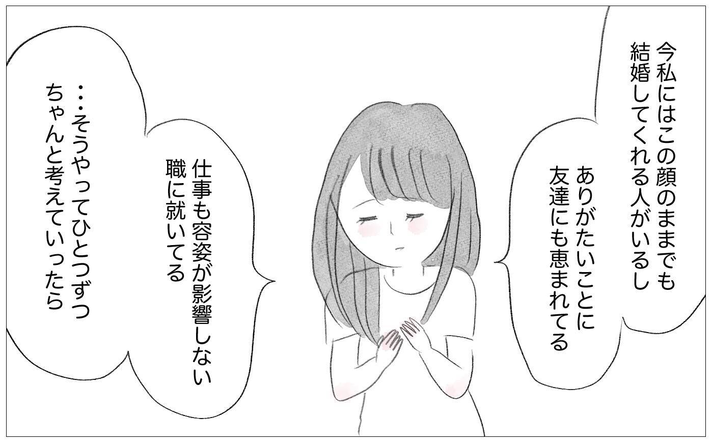 結婚式に向けて整形を勧める母　もう手術はしないと告げると…