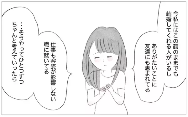 「結婚式に向けて整形を勧める母　もう手術はしないと告げると…」の画像