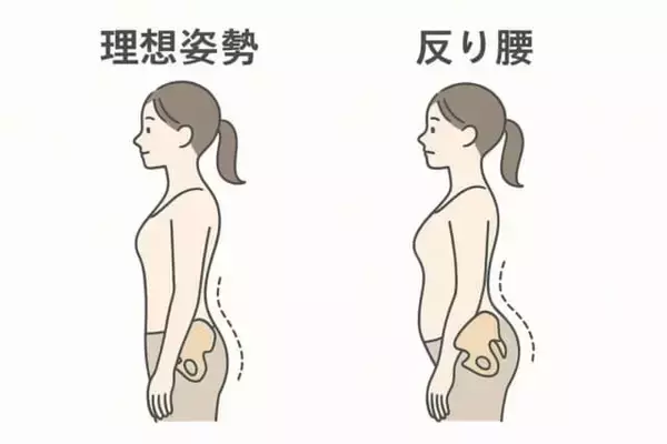 反り腰を改善する効果も。１日１分【お腹痩せ＆くびれ作りにつながる】簡単ストレッチ