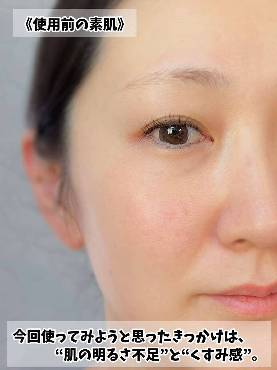 美容ライターが10日間使って検証！大人気ビタミンC美容液で40代のくすみ肌はどう変わった？