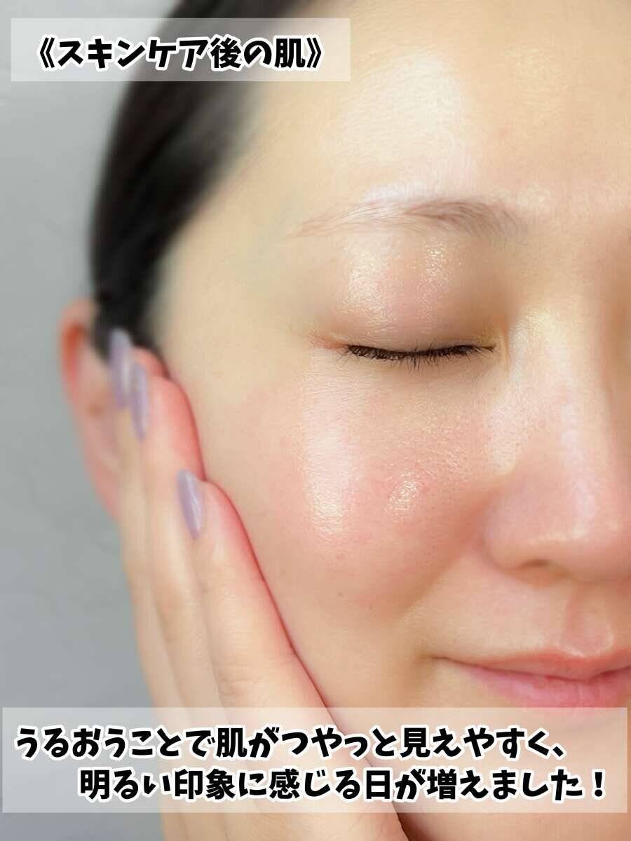 美容ライターが10日間使って検証！大人気ビタミンC美容液で40代のくすみ肌はどう変わった？
