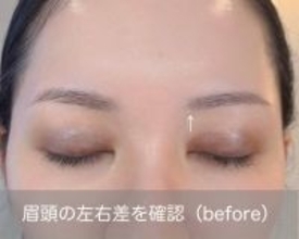 左右の眉がズレる問題、これで解決！眉のバランスを整えるプロのマニュアル